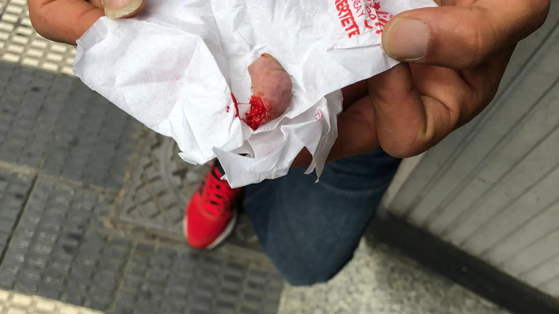 Arranca Un Trozo De Oreja A Otro Hombre En Una Pelea En Torrero De Zaragoza