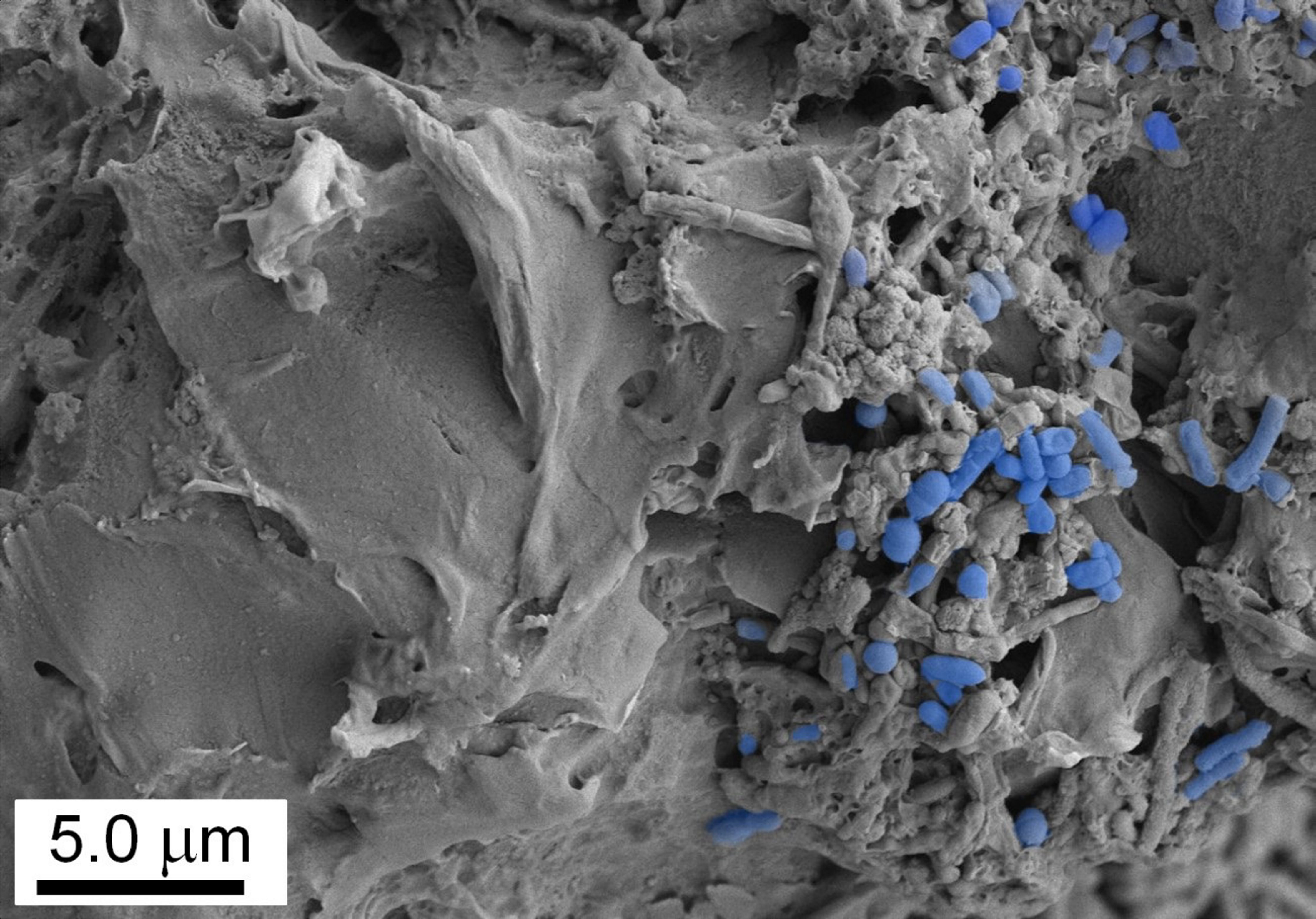 Una experta en medicina reproductiva alerta de que los microplásticos