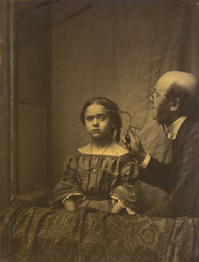 El músculo de la atención. Duchenne contrae la ceja de una niña con estimulación eléctrica (1854-1856).