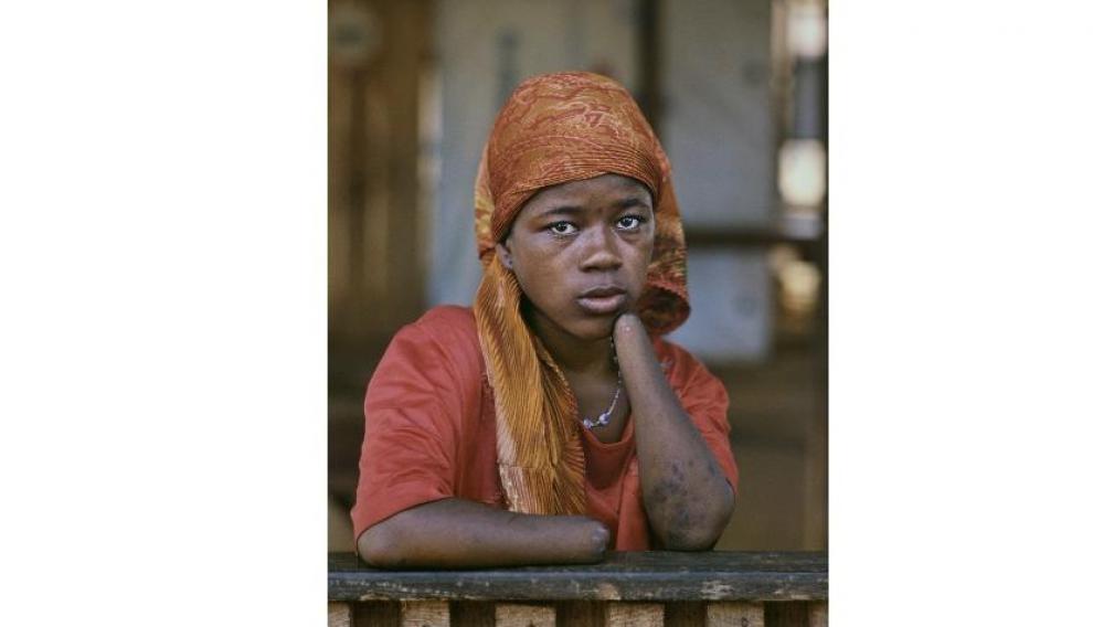 Mariatu Kamara, 15 años, Sierra Leona