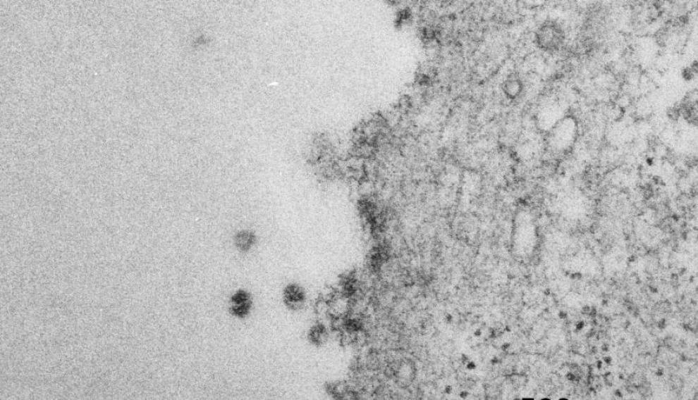 imagen-de-los-primeros-sars-cov-2-aislados-y-fotografiados-en-aragon-mediante-un-microscopio-electronico-de-transmision-1.r_d.444-318-11161.jpeg