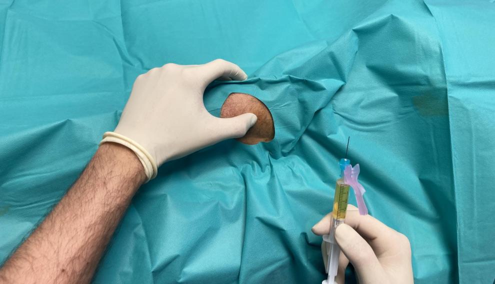 Los tratamientos de medicina regenerativa mejoran la calidad de vida y retrasan en muchas ocasiones la colocación de una prótesis.