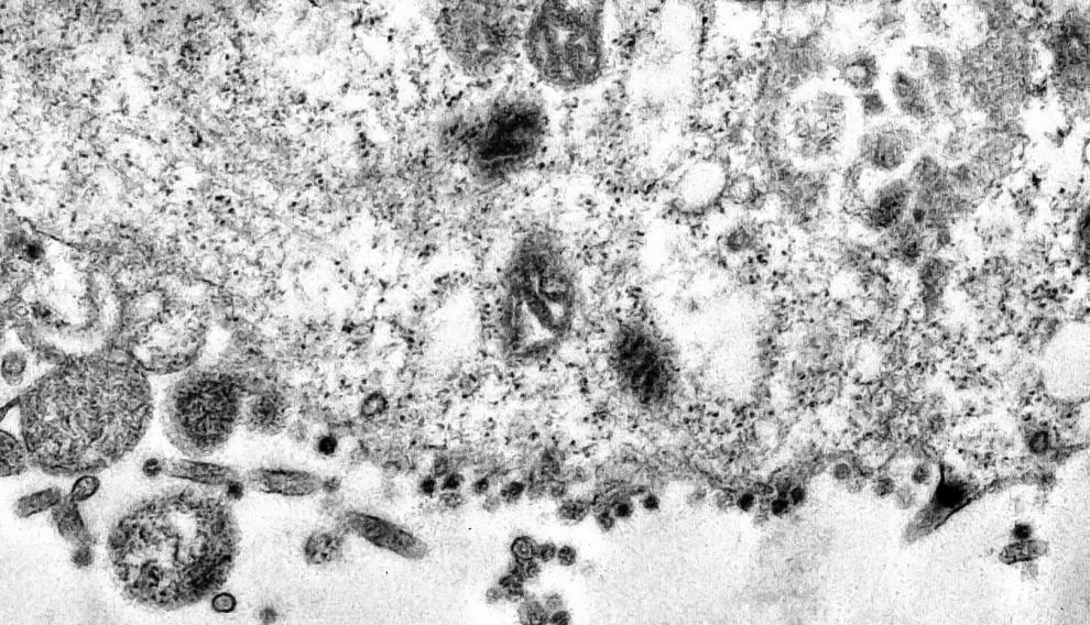 Así infecta el coronavirus a una célula
