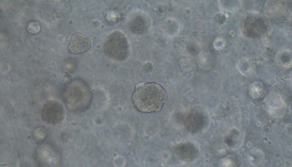 Organoides de pulmón