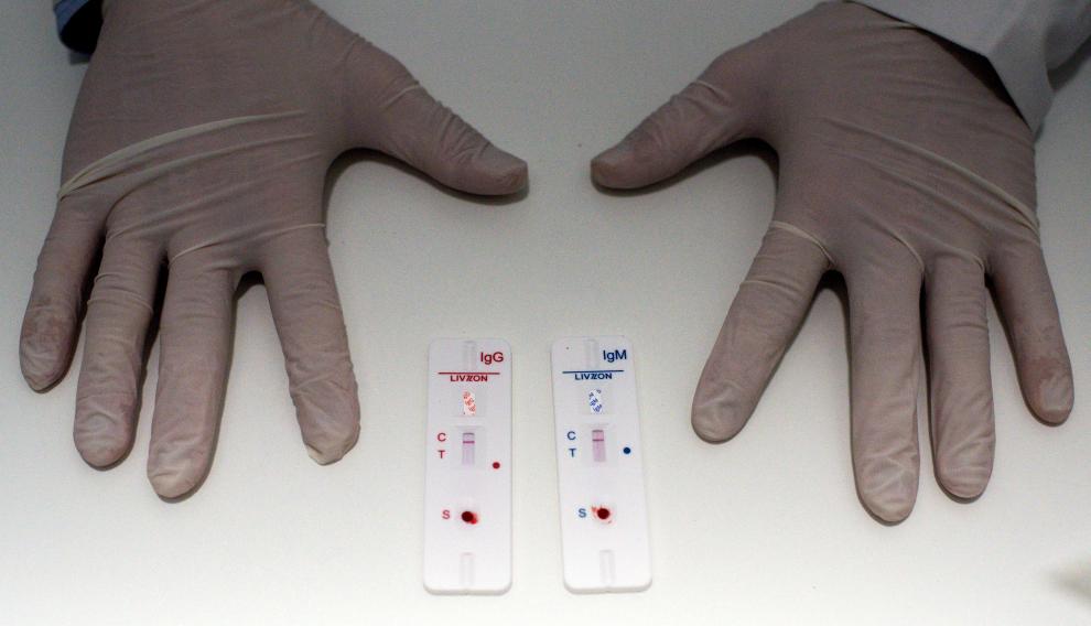 Imagen de los test rápidos que se están haciendo en las farmacias gallegas.