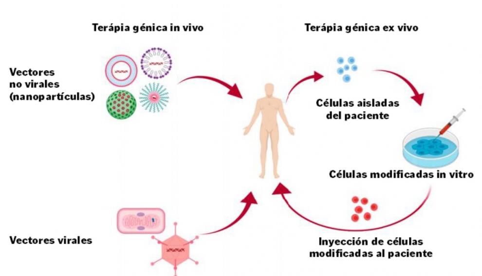 Existen dos tipos de terapia génica: las terapias ‘in vivo’ y las terapias ‘ex vivo’