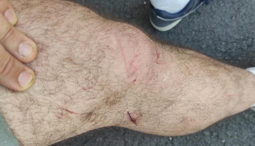 Carlos Yubero muestra algunas de las heridas que se hizo en la pierna cuando buscaba a la mujer en el pantano.