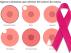 Signos externos del cáncer de mama