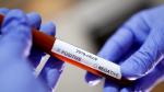 FILE PHOTO: Test tube with Corona virus name label is seen in this illustration taken on January 29, 2020. REUTERS/Dado Ruvic/File Photo [[[REUTERS VOCENTO]]] HEALTH-CORONAVIRUS/TELEHEALTH