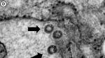 El coronavirus SARS-CoV-2 infecta un cultivo celular.