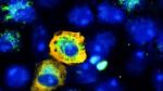 Cuando el SARS-CoV-2 (amarillo) infecta las células de riñón de mono, reduce el mecanismo de reciclaje celular, lo que significa que hay menos señales de autofagia (verde) que en las células no infectadas. La tinción azul representa los núcleos.