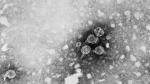 El virus de la hepatitis B, visto al microscopio electrónico.