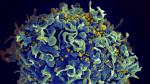 Célula T humana (en tono azul), atacada por el VIH.