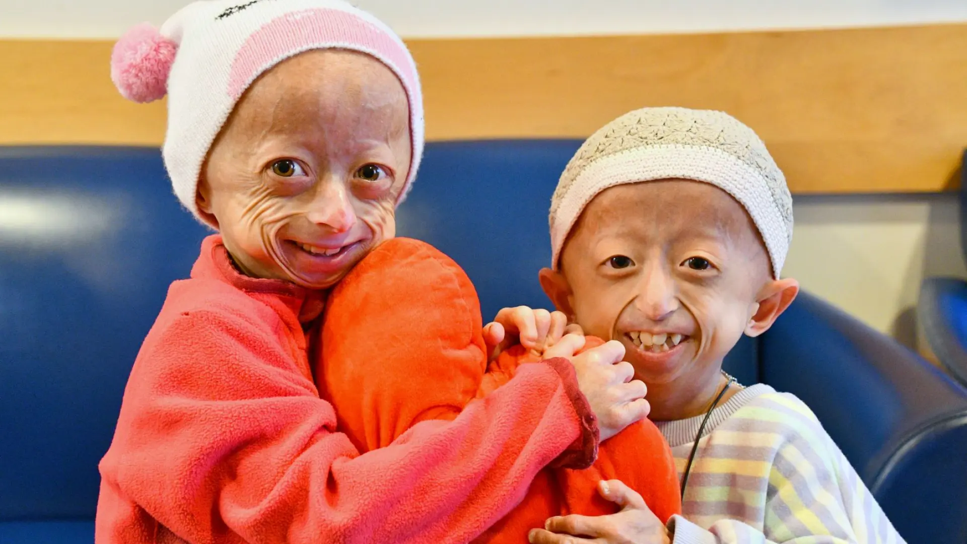 Progeria: un viaje hacia la esperanza y la curación