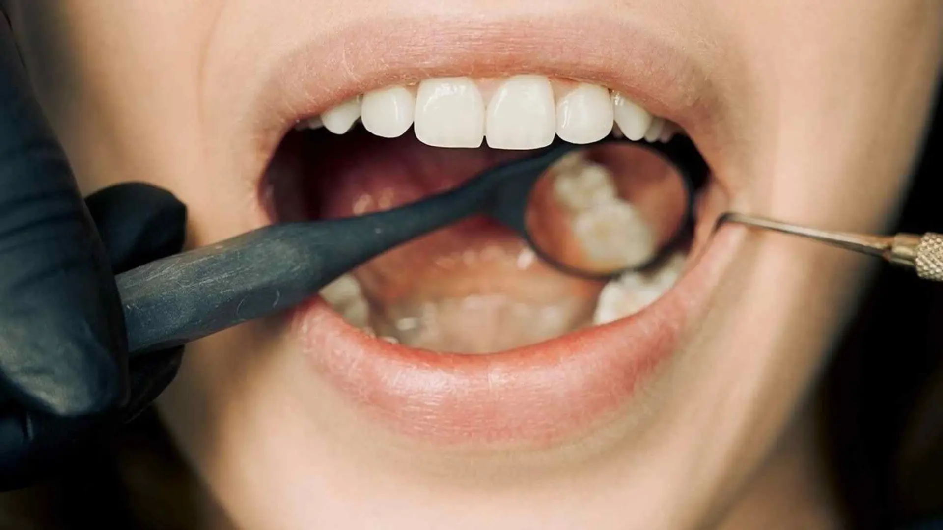 Cómo quitar el sarro de los dientes de forma natural en casa: el truco más fácil y efectivo