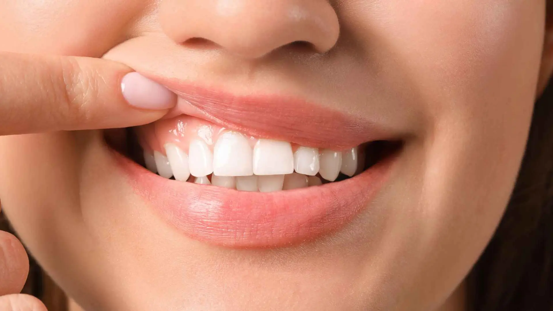 Cómo quitar el sarro de los dientes en casa de forma natural: el remedio más fácil