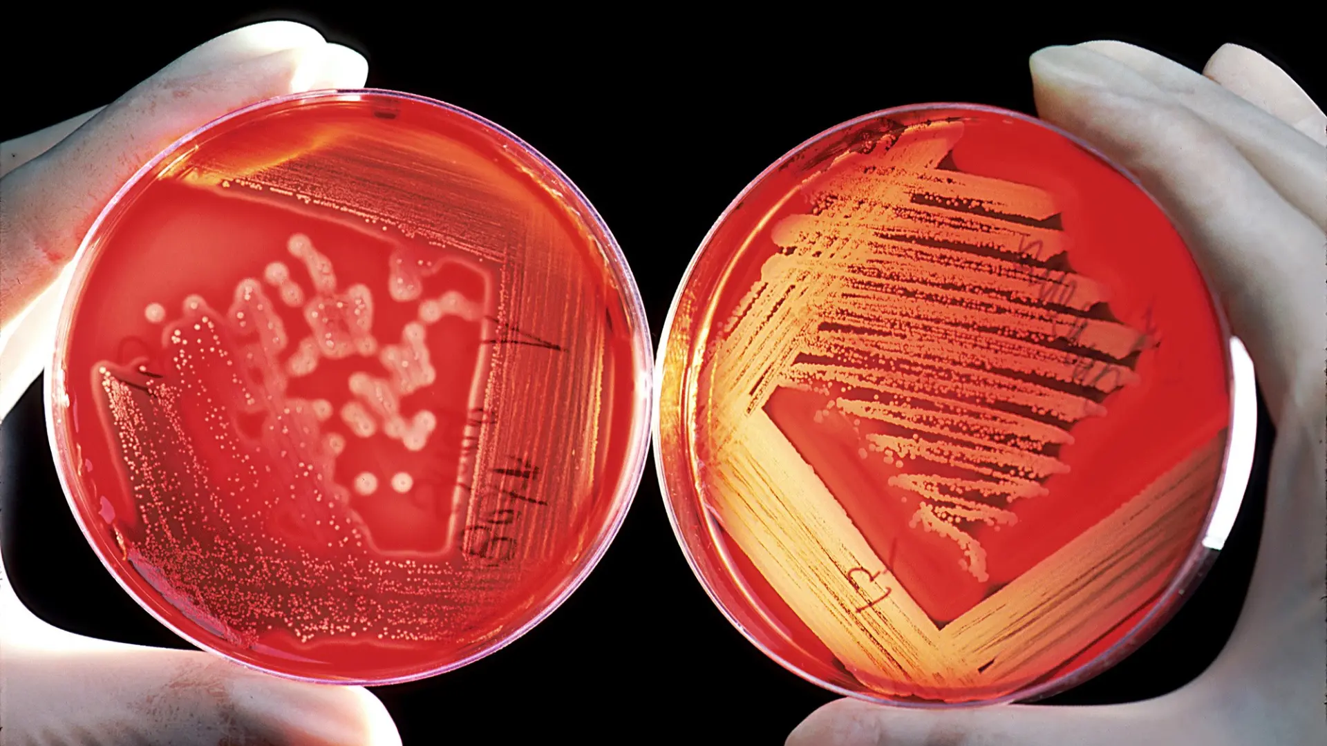 Inteligencia artificial para predecir si una bacteria se volverá resistente a los antibióticos