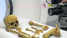 El cráneo y los huesos de Juan de Lanuza, justicia de Aragón en el siglo XVI, son examinados en un equipo de tomografía axial para esta investigación.