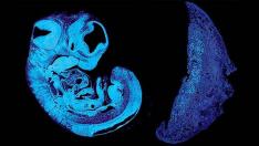 La "guerra de sexos" comienza en el útero cuando los genes del padre y la madre se pelean por la nutrición.