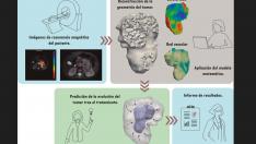 Los modelos matemáticos parten de las imágenes de resonancia magnética realizadas a cada paciente y permiten obtener predicciones individualizadas.