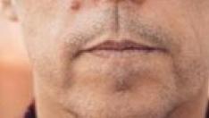 Ferreiro
