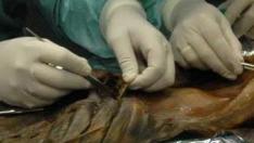 Un grupo de científicos analiza el contenido estomacal de Ötzi fallecido hace 3.500 años y que tenía una tasa muy alta en grasa.