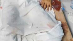 Los palestinos heridos en ataques israelíes yacen en el suelo mientras son asistidos en el hospital indonesio después de que el hospital Al Shifa quedara fuera de servicio