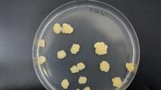 Cultivo de Mycobacterium tuberculosis, la bacteria que causa esta enfermedad infecciosa