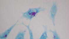 El bacilo de la tuberculosis crece dentro de células humanas