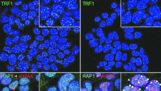 Las células de cáncer de pulmón tratadas con el inhibidor de TRF1 del CNIO muestran menos TRF1 unido a sus telómeros y un mayor daño del ADN telomérico y, por tanto, una mayor desprotección de los telómeros que las células cancerosas sin tratar.