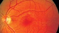 Esta novedosa técnica de neuroimagen se conoce como 'ventana al cerebro' y puede servir para un rápido diagnóstico de la esquizofrenia.