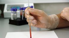 Un nuevo test sanguíneo mejora la detección de recurrencias del cáncer de colon