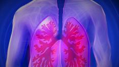 La EPOC afecta a la salud pulmonar.