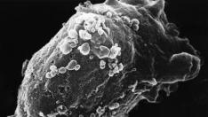 Vista al microscopio electrónico de un linfocito con VIH