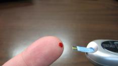 Foto de archivo de una persona midiéndose el azúcar en sangre.