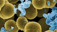 Staphylococcus aureus huyendo de leucocitos humanos.
