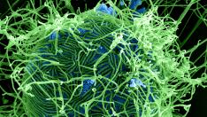 Filamentos del virus del ébola atacan una célula