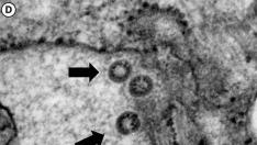 El coronavirus SARS-CoV-2 infecta un cultivo celular.