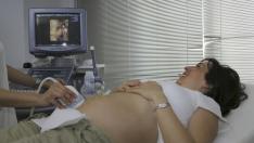 Durante la pandemia mundial de covid-19 las consultas a mujeres embarazadas han cambiado.