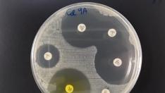 Cultivo bacteriano que resiste la acción de un antibiótico mientras los otros son eficaces contra él