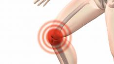 Artrosis de rodilla