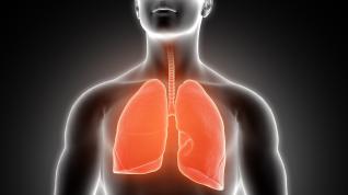 El cáncer de pulmón podría afectar a más de 40.000 personas en el año 2035.