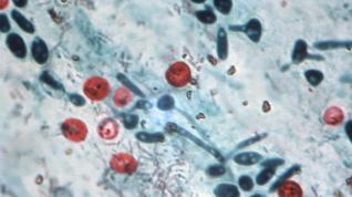 Imagen del protozóo cristosporidium