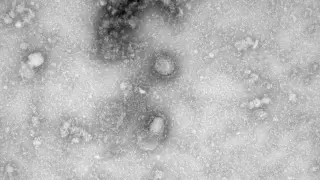El coronavirus a vista de microscopio