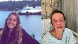 Marta Bustos antes y después del accidente