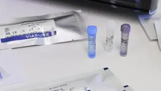 Kit de diagnóstico de la viruela del mono desarrollado por Certest.
