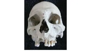 Uno de los cráneos de los 44 fallecidos de la prehistoria encontrados en la Muela de Borja.