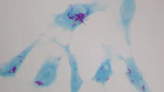 El bacilo de la tuberculosis crece dentro de células humanas