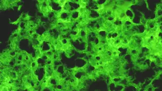 Teñidas con auramina (en verde), masas de bacilos de la vacuna BCG
