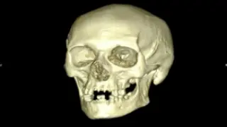 cráneo de Ramiro II el Monje